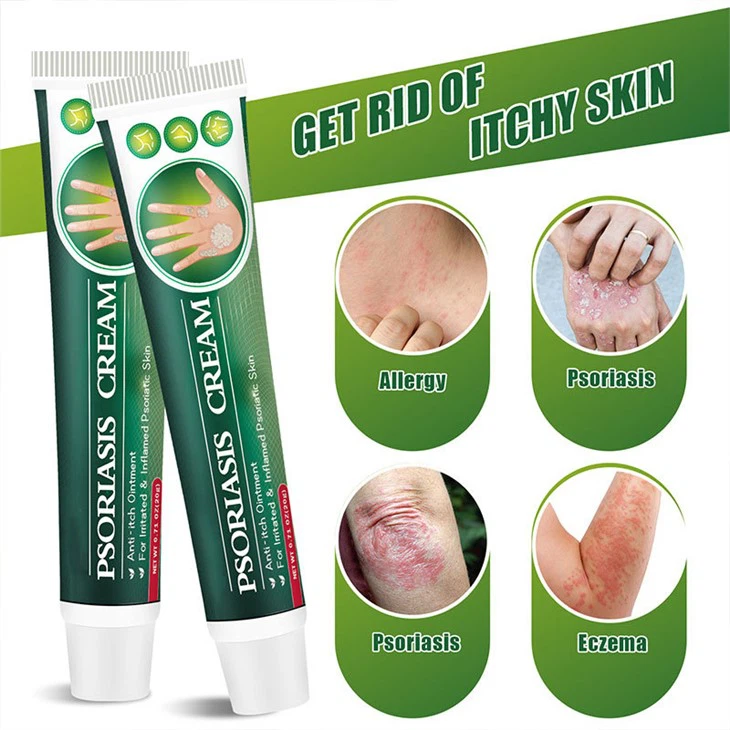 Fungal Infection Psoriasis Cream Skin Cream